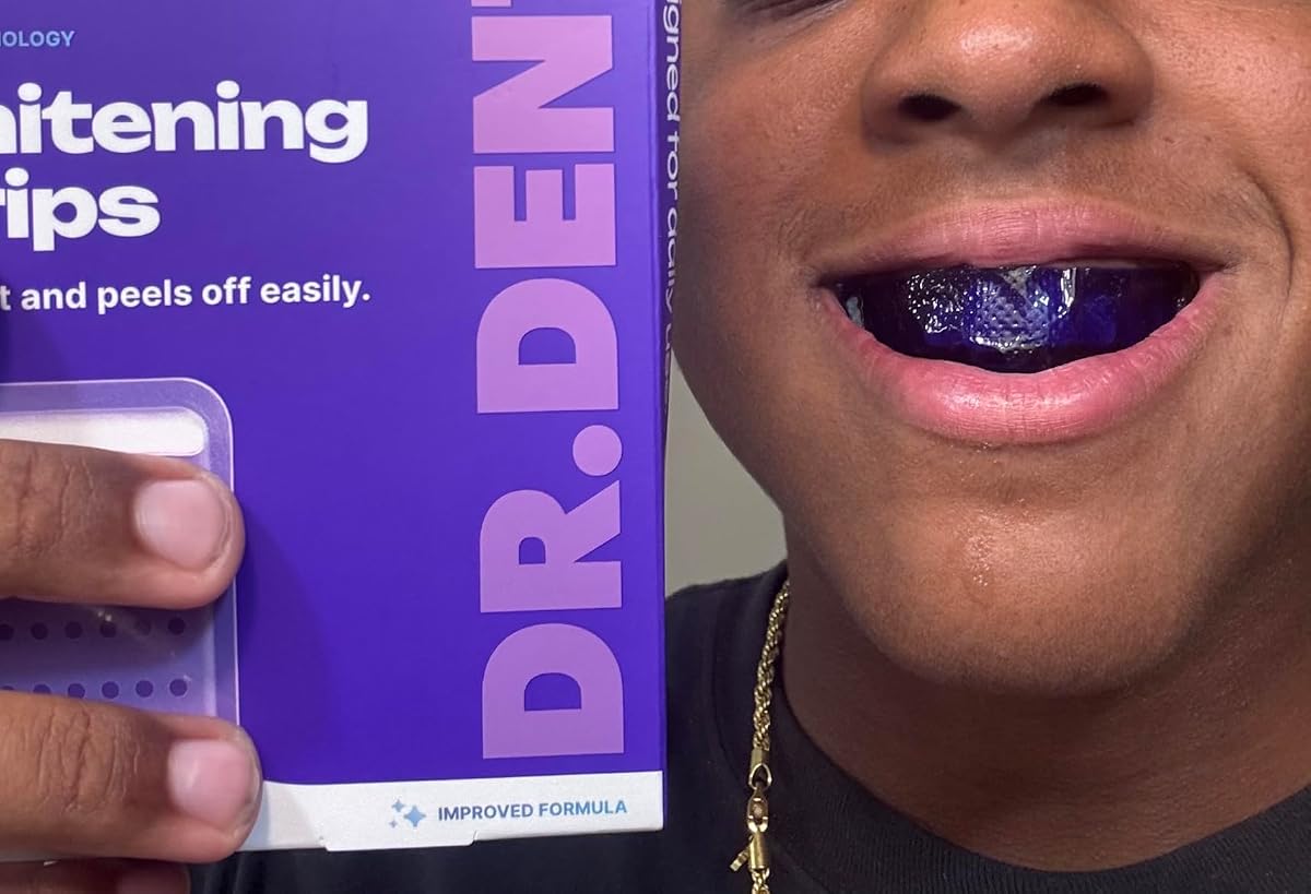 Customer photo: a DrDen violet strip worn on the upper teeth, box in hand